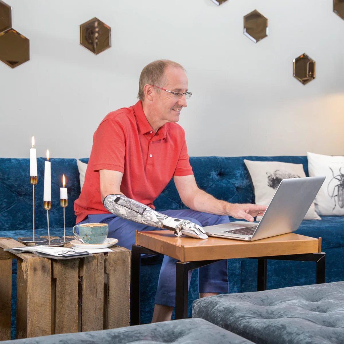 A prosthetic arm user browsing on their laptop in their living room