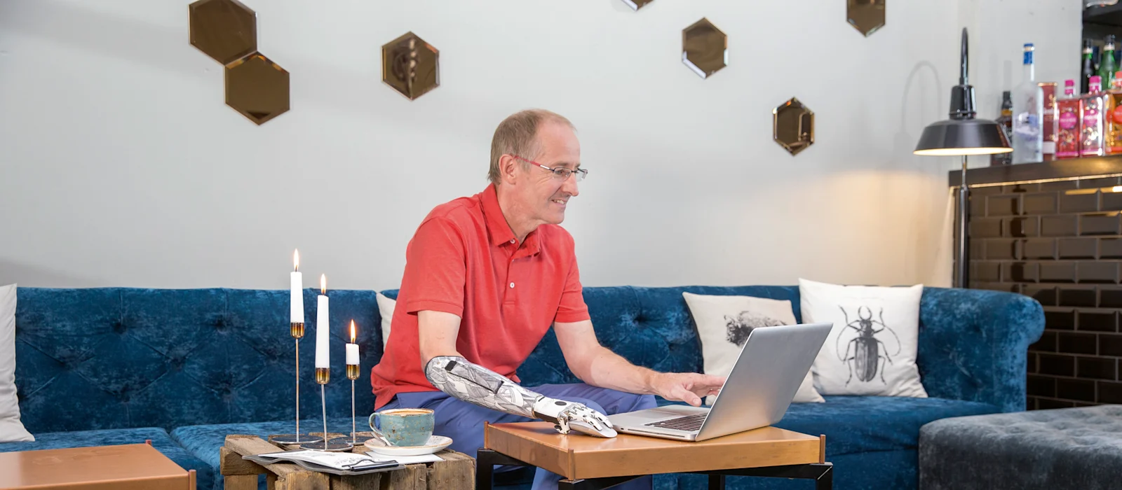 A prosthetic arm user browsing on their laptop in their living room