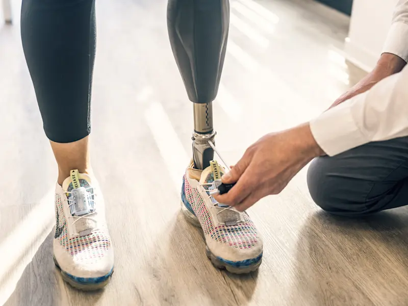 A prosthetist measuring a patient's shoe while wearing an artificial leg