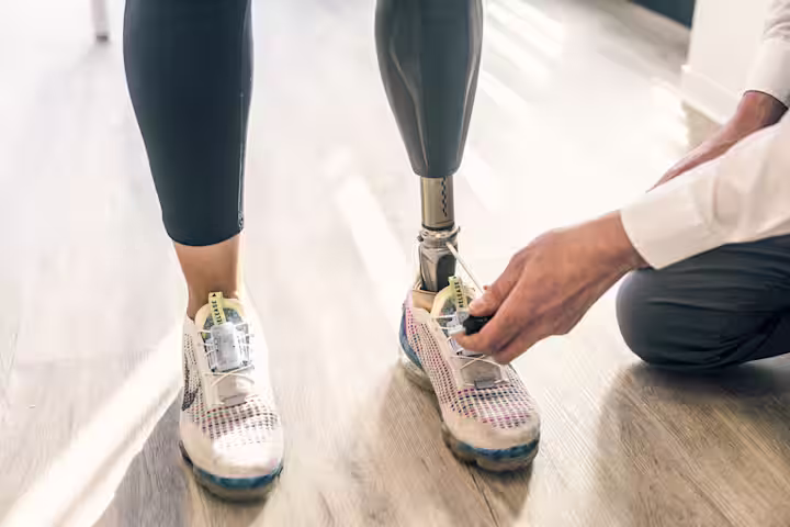 A prosthetic leg user's artificial limb being adjusted by a Certified Prosthetist Orthotist (CPO)