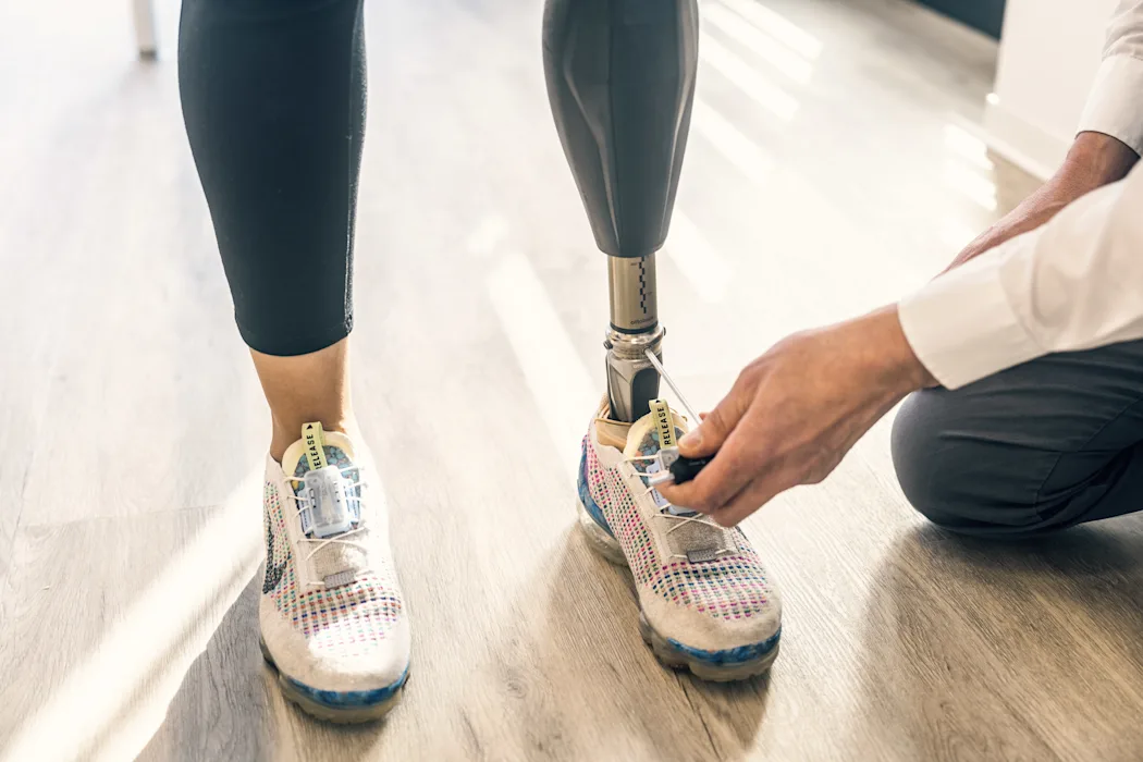 A prosthetic leg user's artificial limb being adjusted by a Certified Prosthetist Orthotist (CPO)