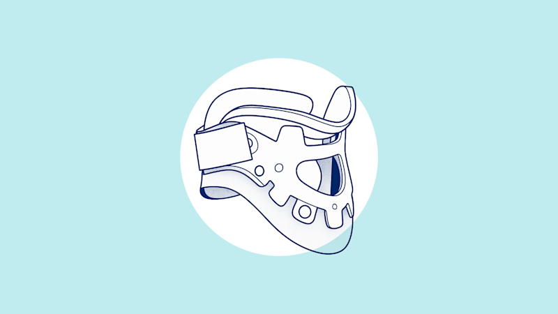 An illustration of a neck brace, also known as a Cervical Orthosis or Cervical Collar