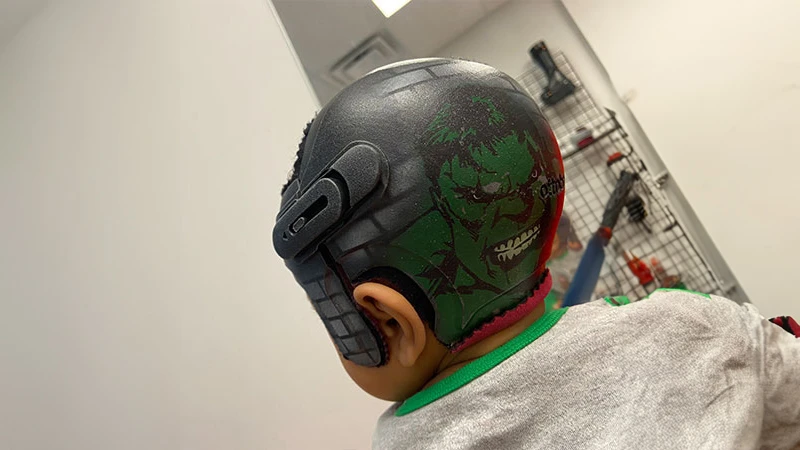 Un paciente pediátrico usando un casco craneal MyCRO Band con un diseño personalizado de Hulk.