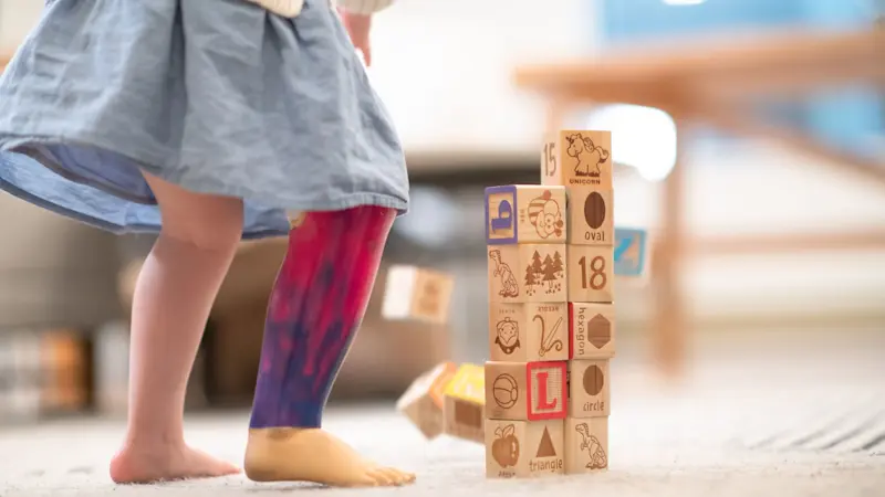 A close up of a kid's prosthetic leg