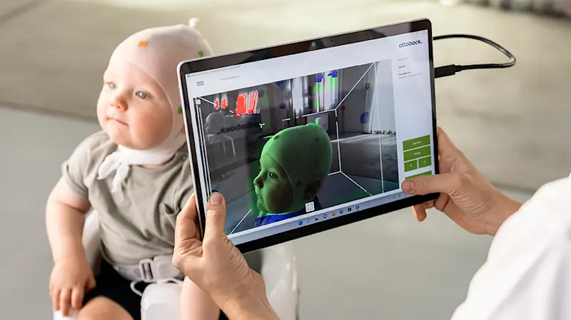Un bebé que usa una gorra mientras su cráneo está siendo escaneado por un CPO usando el EasyScanner