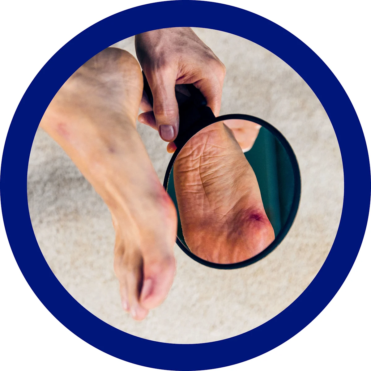 4881648-Sindrome-piede-diabetico-circle-blue (ITA)