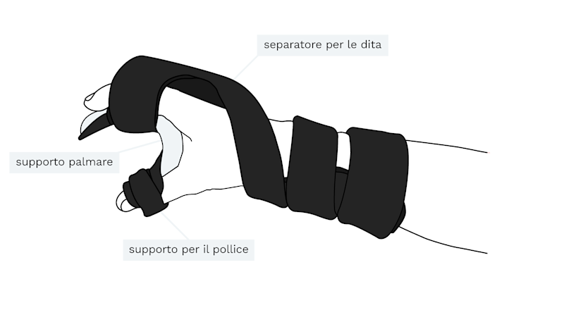 Illustrazione dell'ortesi neurologica Neuro Soft