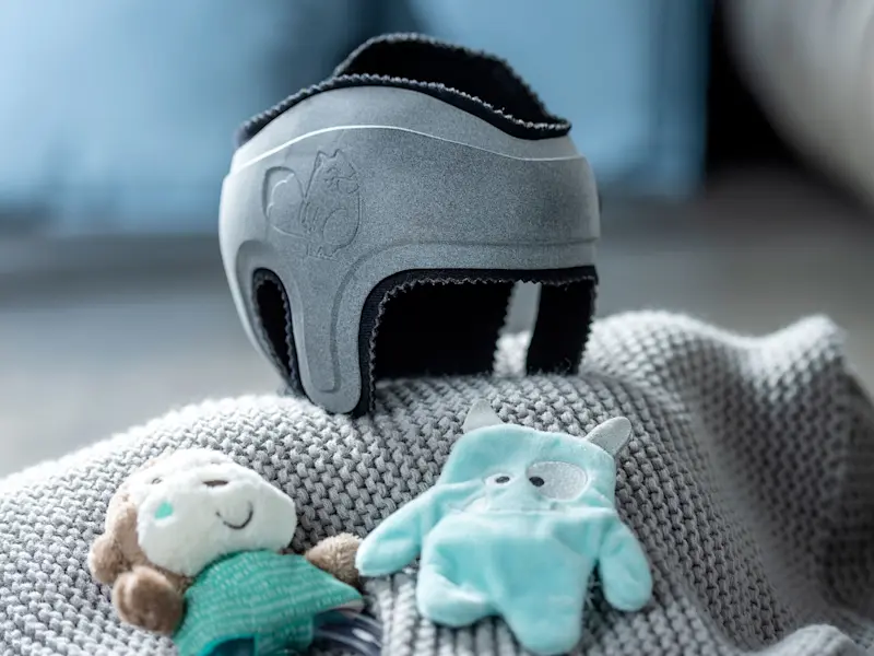 A custom MyCRO band cranial helmet by Ottobock