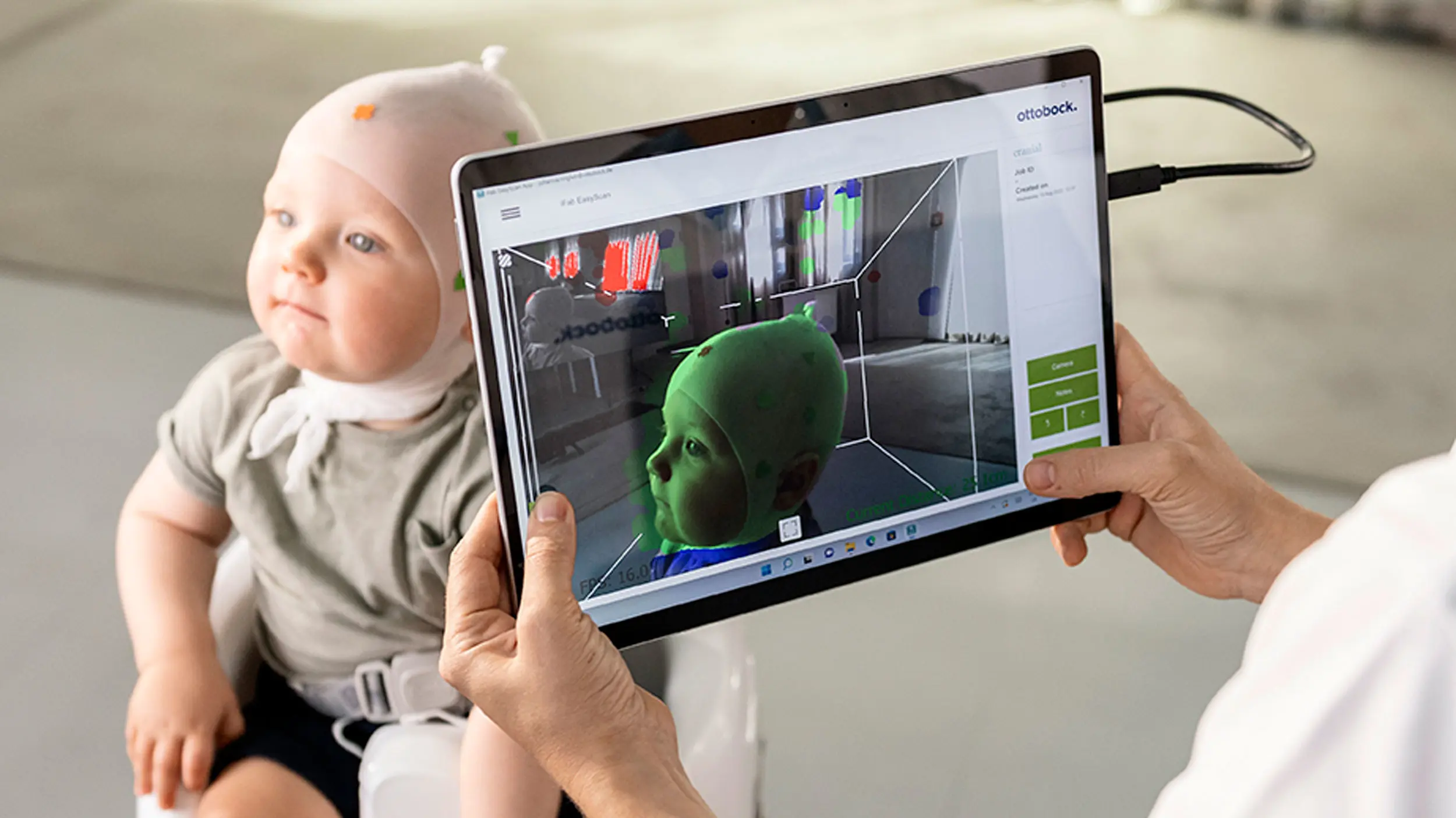 A Certified Pediatric Orthotist using a 3D scanner to map a child's head shape for a cranial remolding helmet