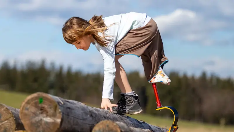 dysmelie-dysmelie-banner-169 (ITA)