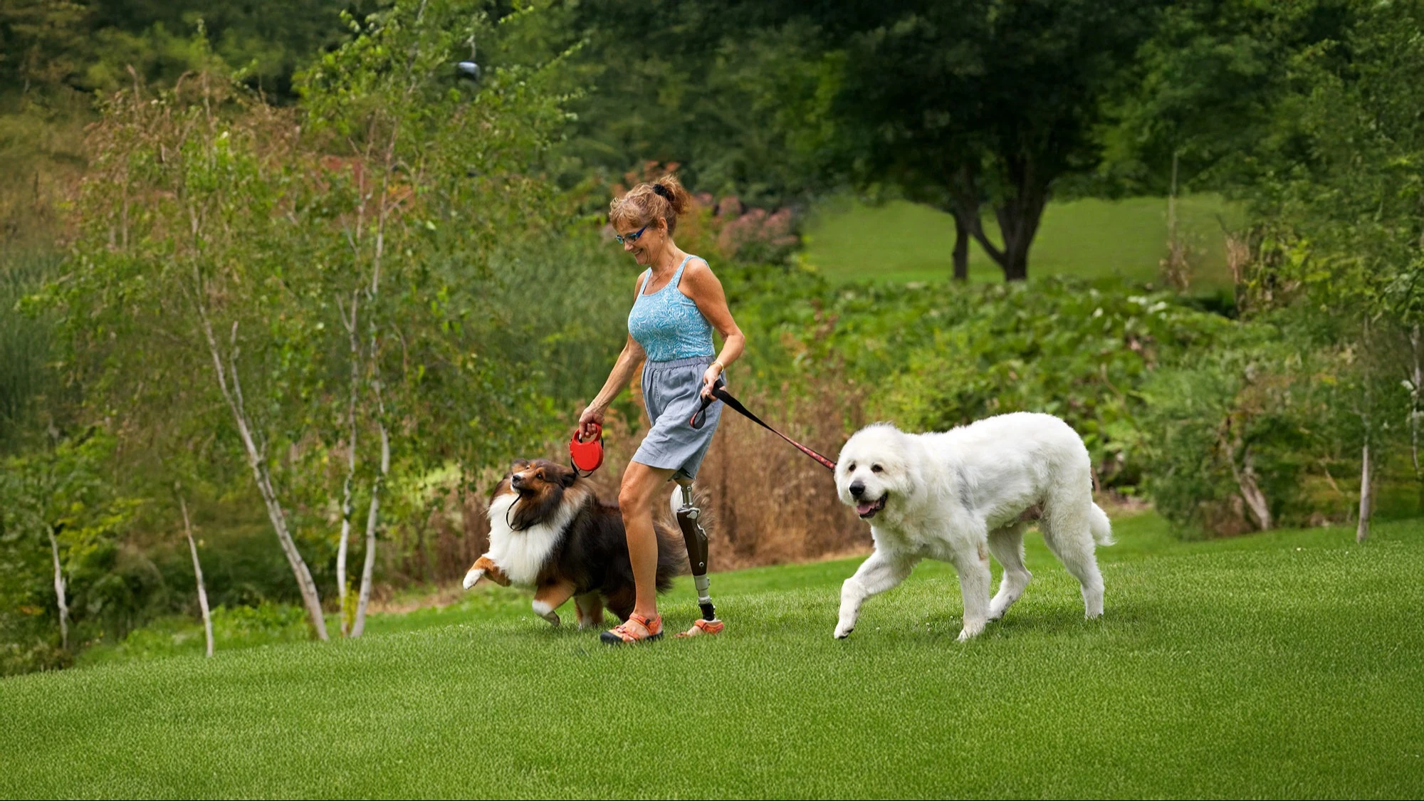 A woman in a prosthetic leg walking two dogs through an outdoor park