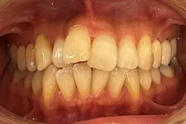 Before Image