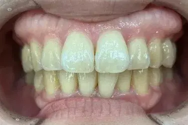 Before Image