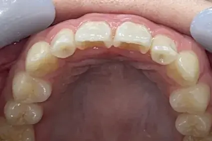 After Image