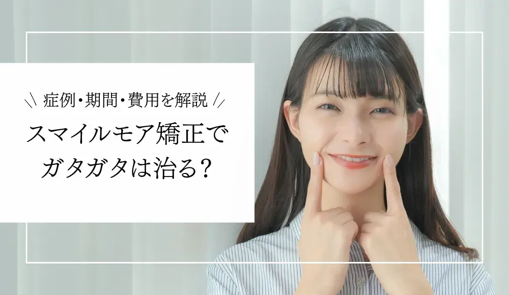 【症例写真あり】スマイルモア矯正でガタガタは治る？費用・期間を歯科医師が解説