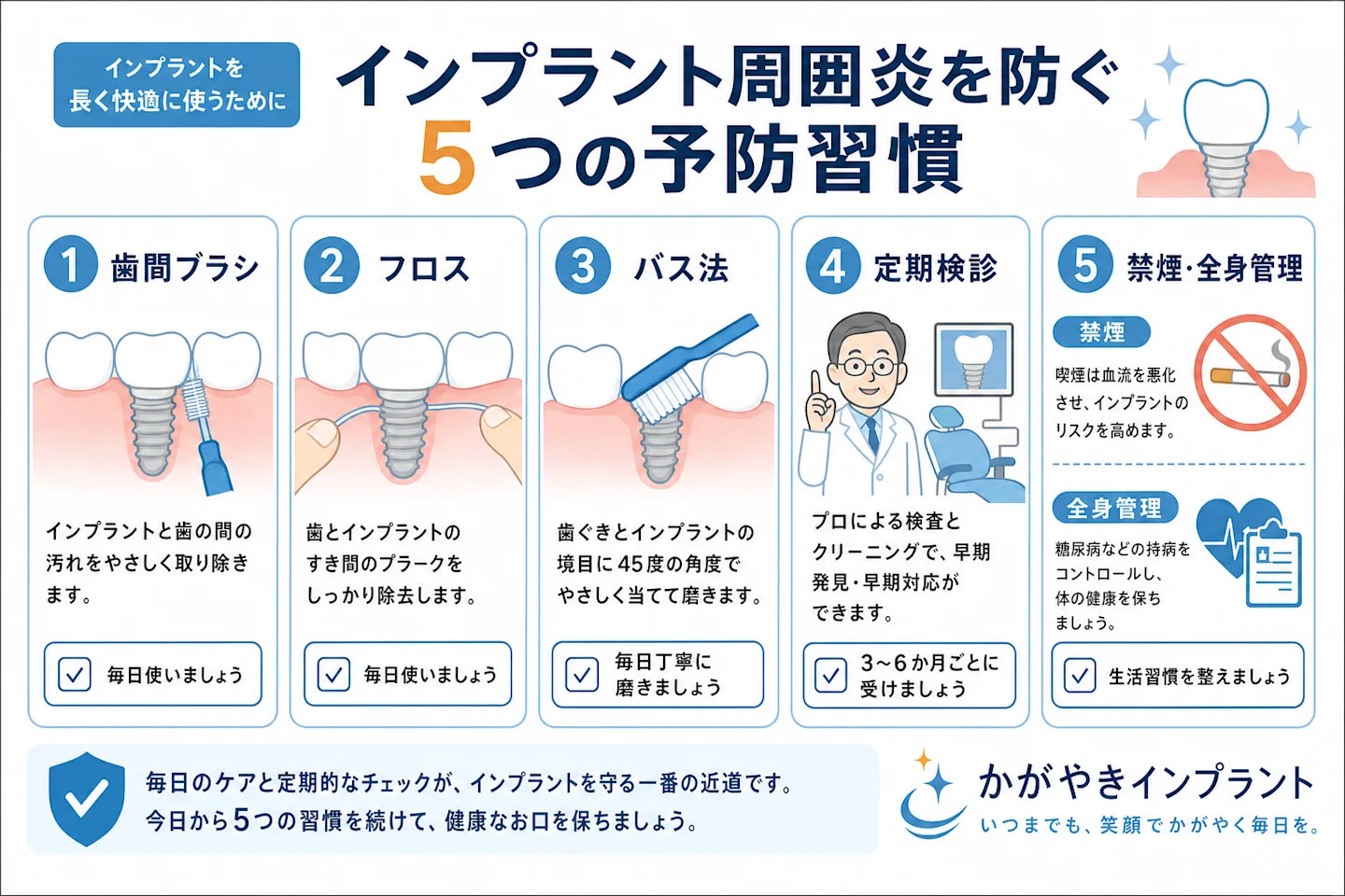 インプラント周囲炎を防ぐ5つの予防習慣を示すイラスト