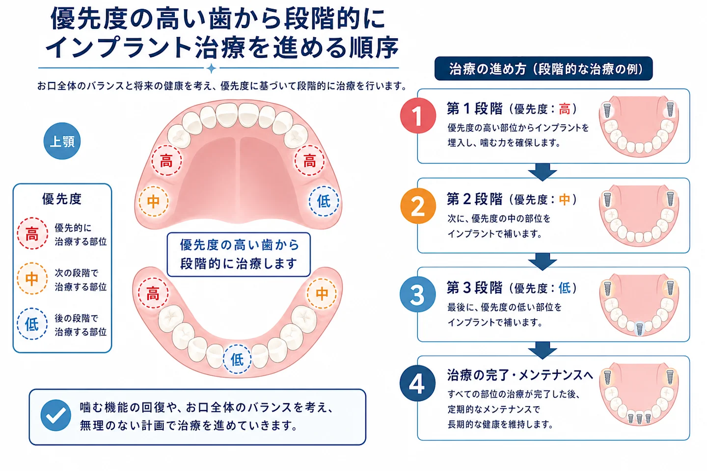 優先度の高い歯から段階的にインプラント治療を進める順序を示した図