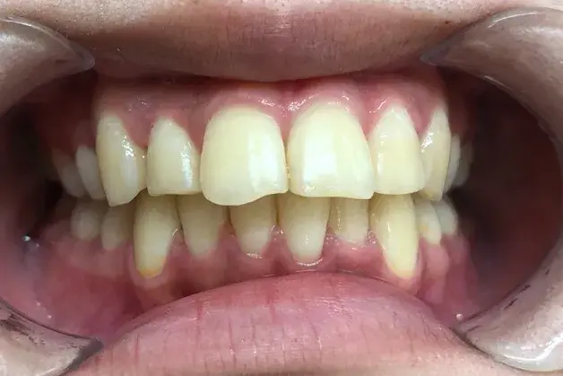 Before Image