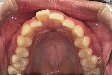 Before Image