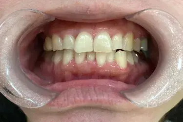 Before Image