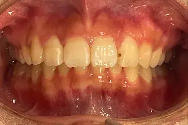 After Image