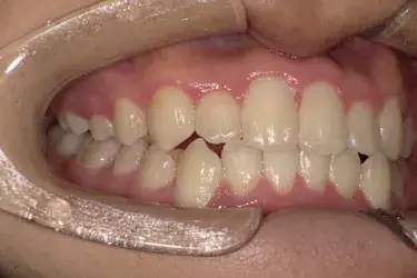 After Image