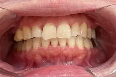 After Image