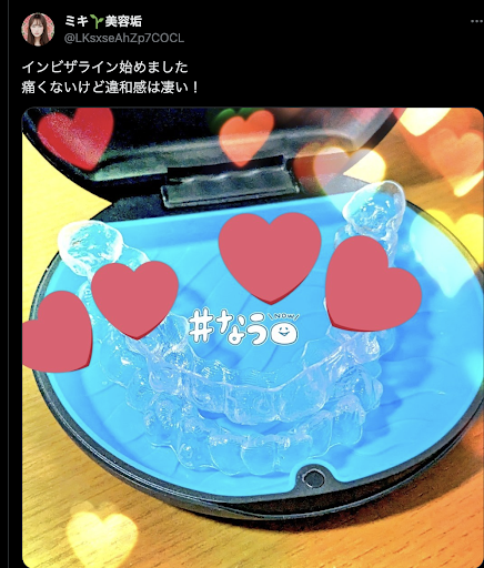 インビザライン痛みの口コミ２