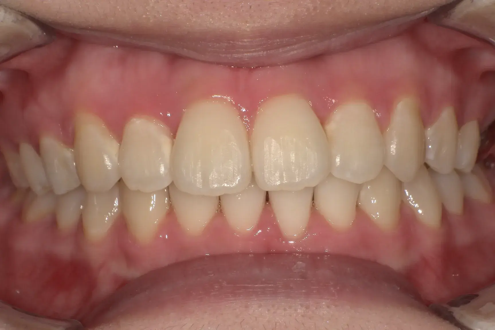 After Image