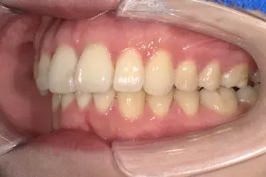 After Image