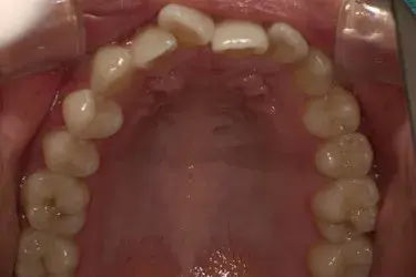 Before Image