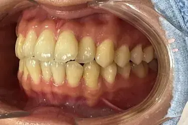 Before Image