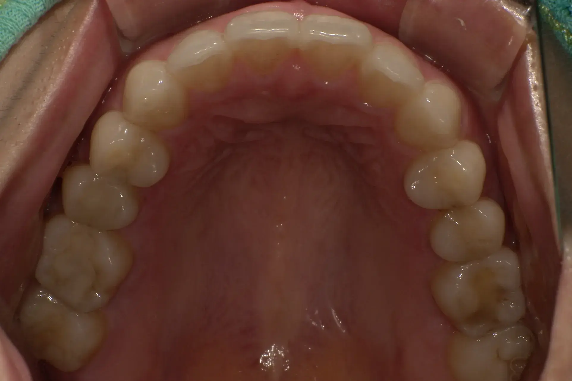 After Image