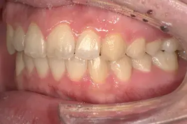 After Image