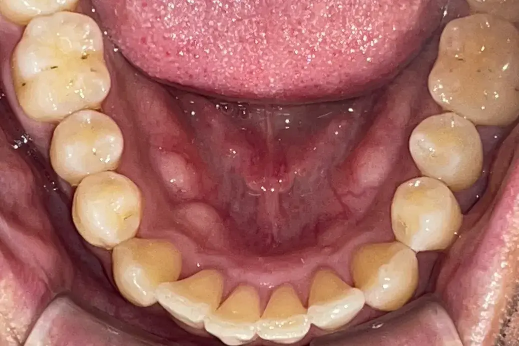 After Image