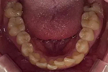 Before Image