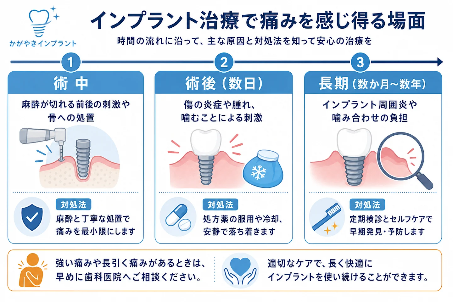 インプラントで痛みを感じ得る術中・術後・長期の3場面を時間軸で示した図解