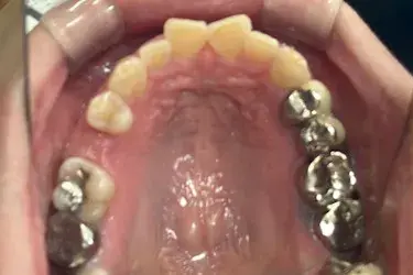 Before Image