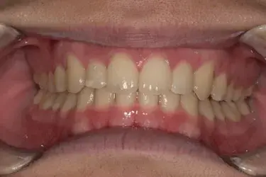 After Image