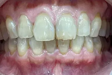 After Image