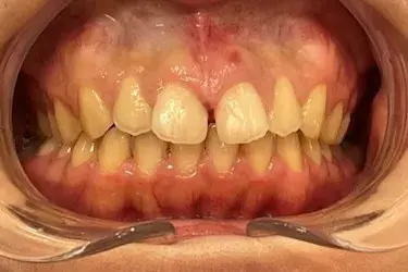Before Image