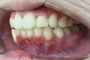 After Image