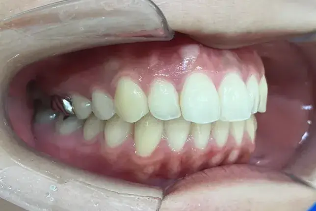 After Image