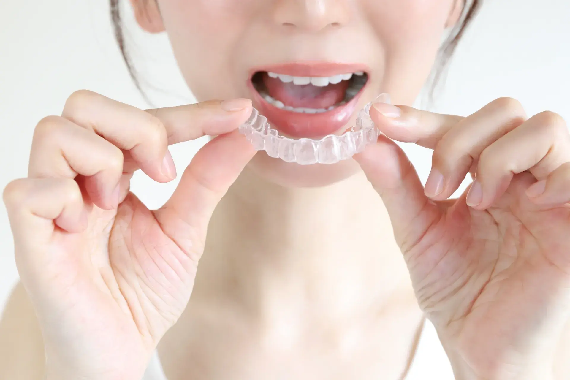 口元のお悩みなら、スマイルモア矯正