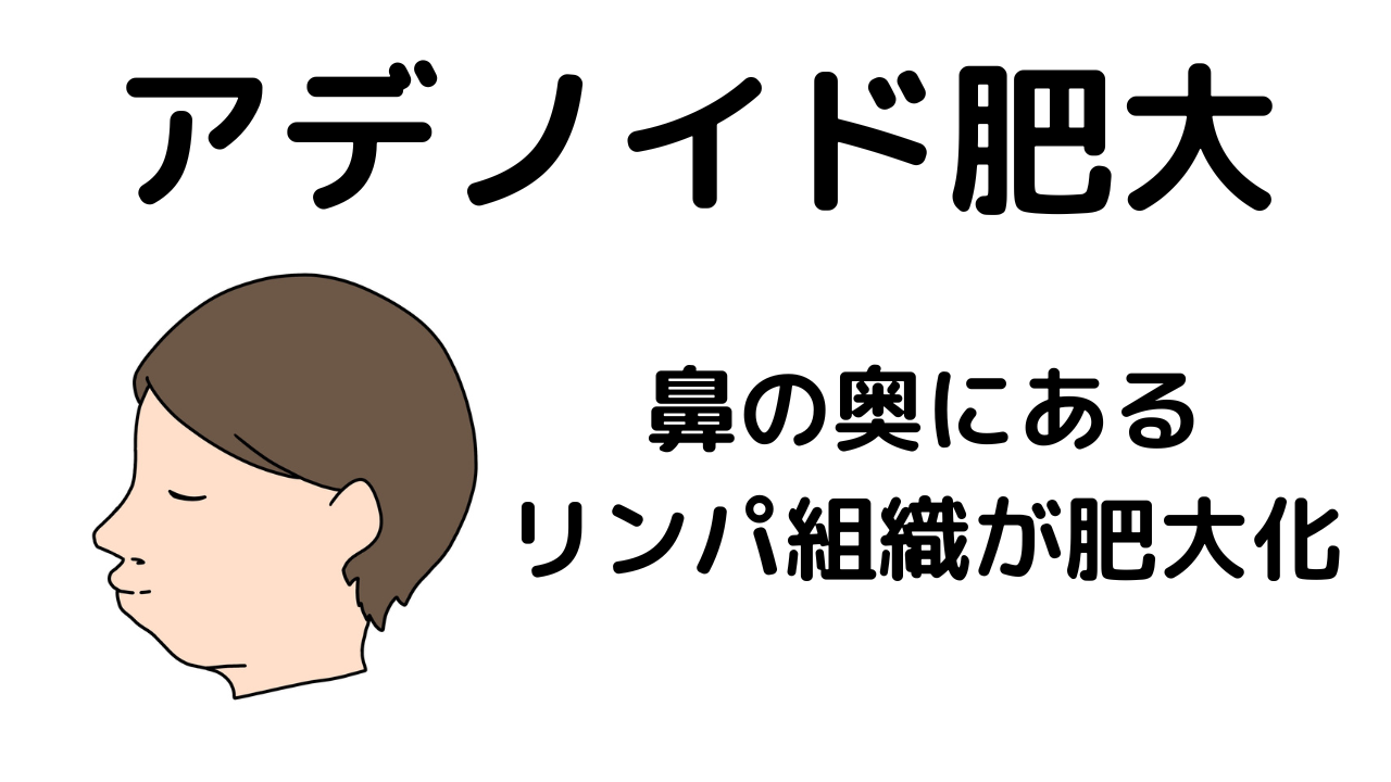 アデノイド肥大