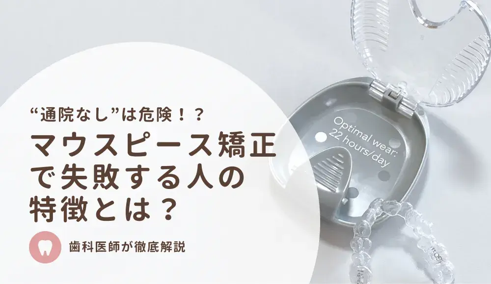 マウスピース矯正で失敗する人の特徴とは？通院なしは危険？歯科医師が解説