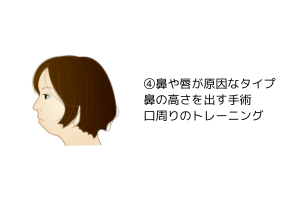 鼻が相対的に低い・唇が分厚いタイプの口ゴボ