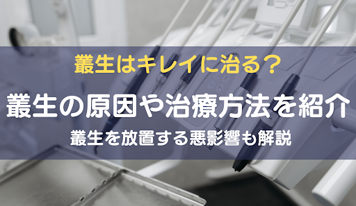 叢生とはアイキャッチ画像