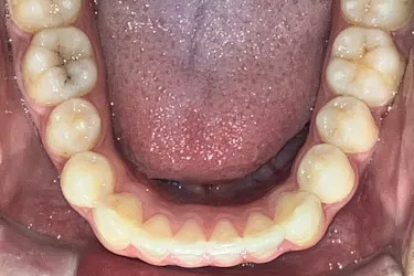 After Image