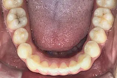 After Image